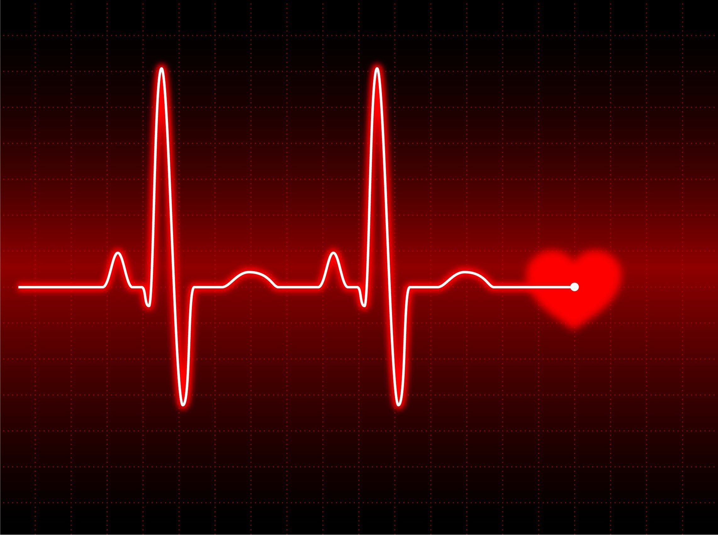 Сильно учащенный пульс. Кардиограмма сердца. Пульс. Пульс кардиограмма. Линия пульса.