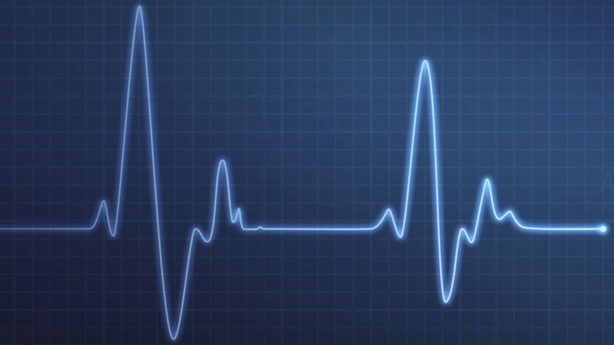 Диаграмма пульса