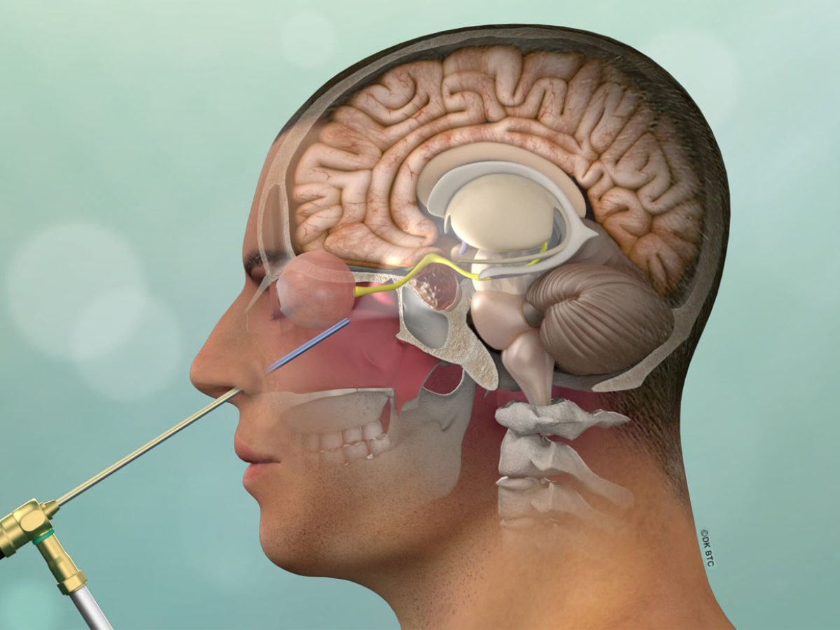 Опухоль головы анимация