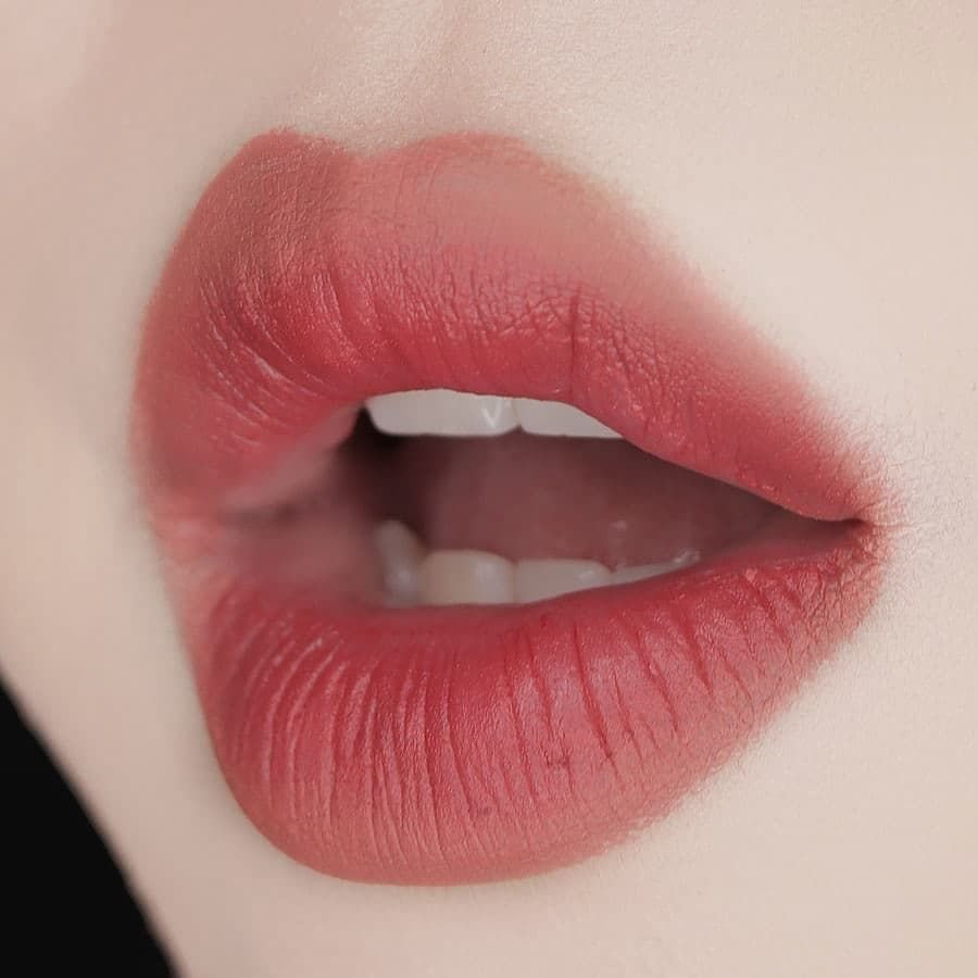 Брекеты с блеском для губ