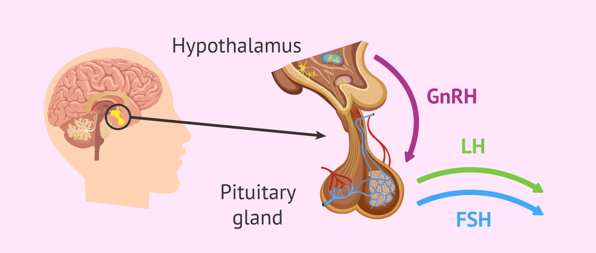 Микроаденома гипофиза мкб