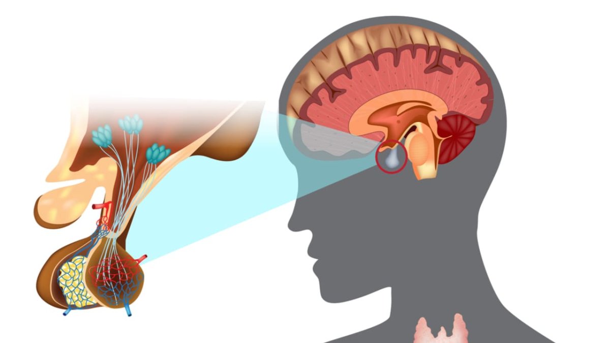 Восстановление гипофиза