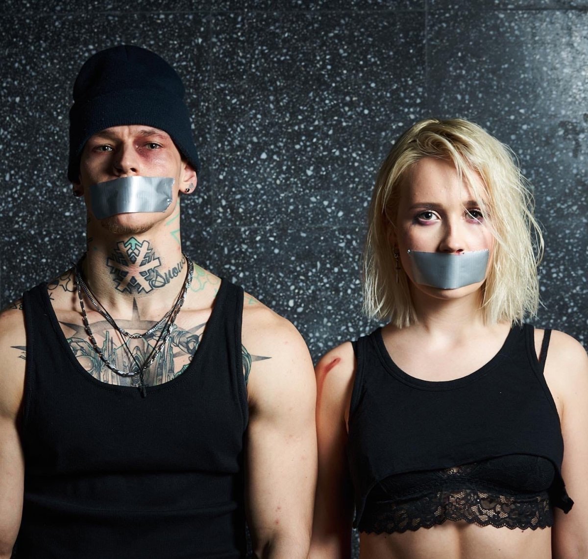 Егор шип шрам