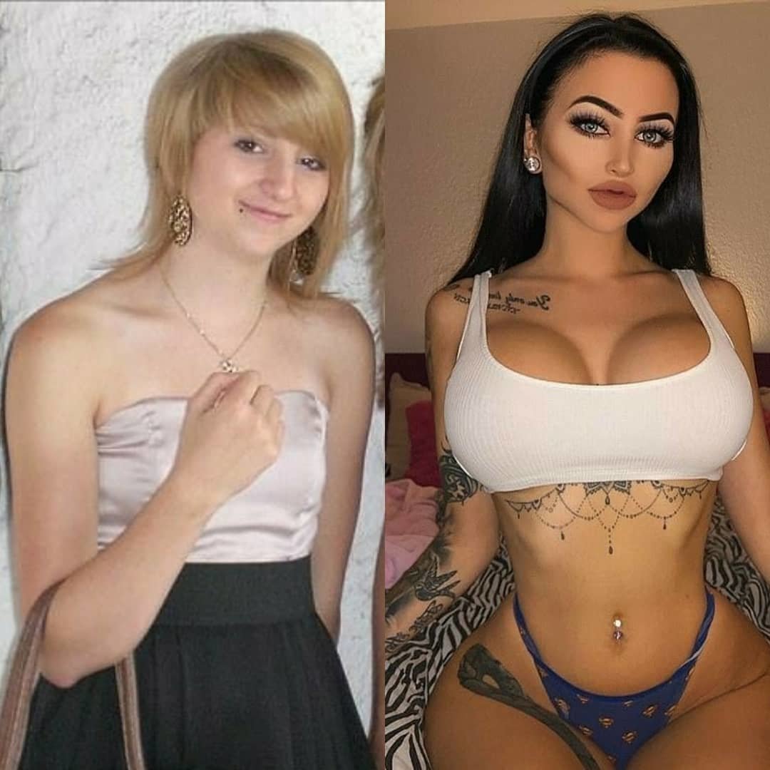 Аве мелисса до пластики