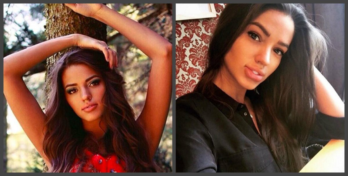 Маммопластика Ольги Бузовой